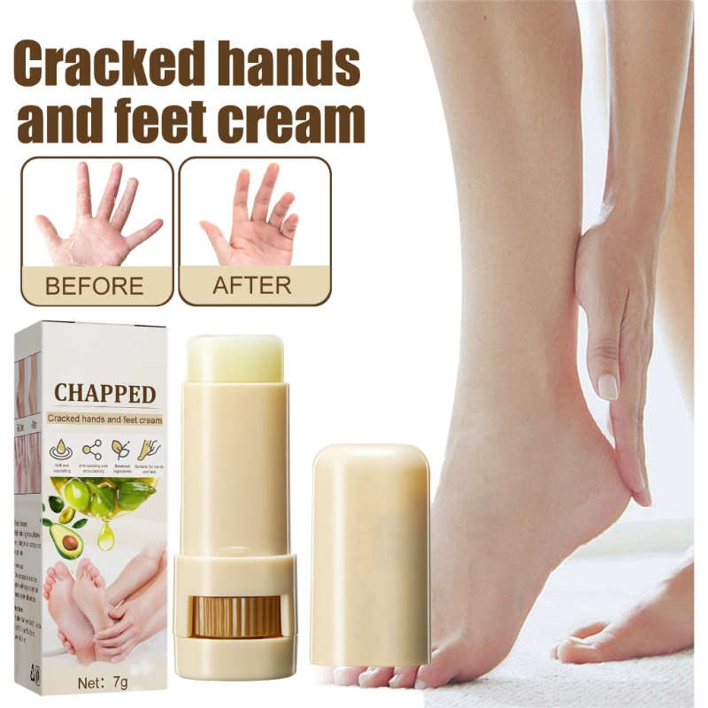 Kem Dưỡng Da Chân YOUYO Tẩy Da Chết Chống Khô Nứt Nẻ Gót Chân
