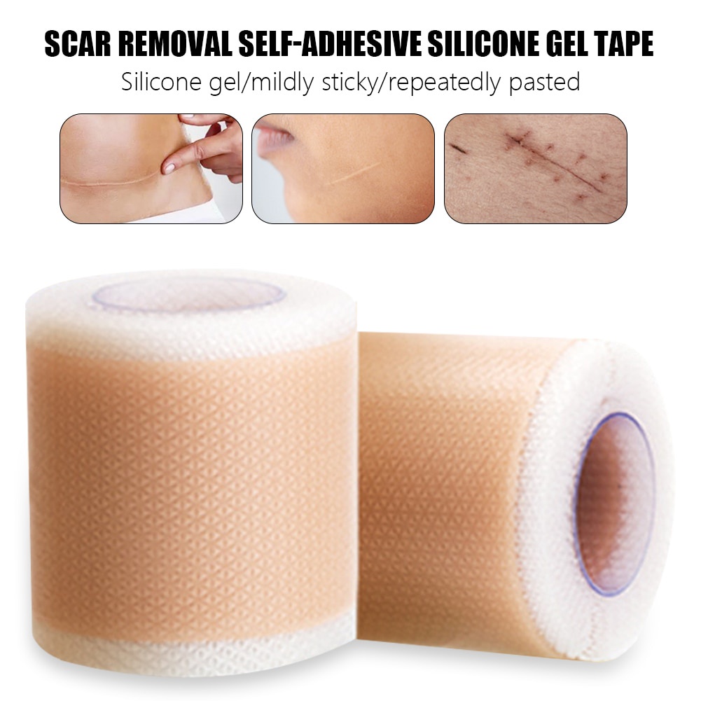 Băng Keo Silicone Dán Hỗ trợ giảm sẹo Mụn/Mụn Trứng Cá Không Làm Tổn Thương Da