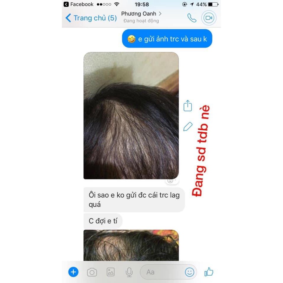 (Tinh dầu bưởi nguyên chất 100%) Giảm rụng tóc, kích thích mọc tóc | BigBuy360 - bigbuy360.vn