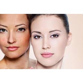 Bộ 2 Kem Thủy Tinh Bạch Day Frost - Dưỡng Trắng Da & Mờ Thâm Nám