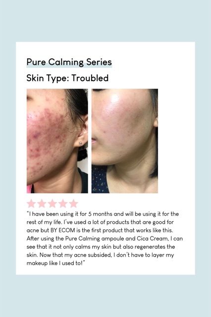Bộ Dưỡng Dành Cho Da Mụn Phục Hồi Da BY ECOM