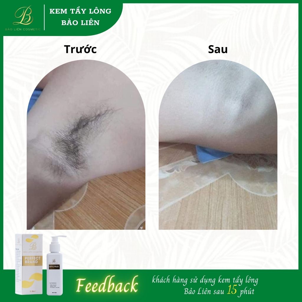 Kem tẩy lông Bảo Liên,triệt lông vĩnh viễn,kem triệt lông,triệt lông nách chỉ sau 10 phút