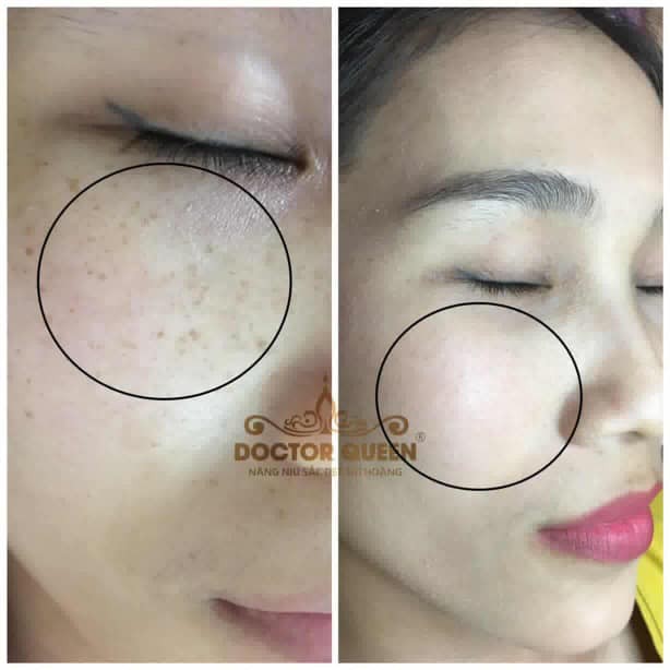 KEM DƯỠNG DA BAN ĐÊM DOCTOR QUEEN