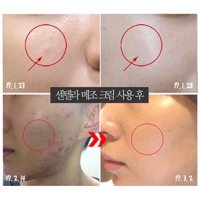 Kem Rau Má Giảm Mụn Phục Hồi Da MediPeel Centella Mezzo Cream | BigBuy360 - bigbuy360.vn