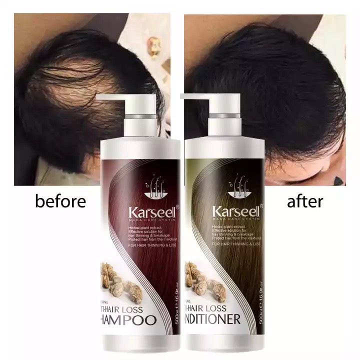 Dầu gội xả chống rụng, kích mọc tóc Karseell Maca Anti Hair Loss 500ml