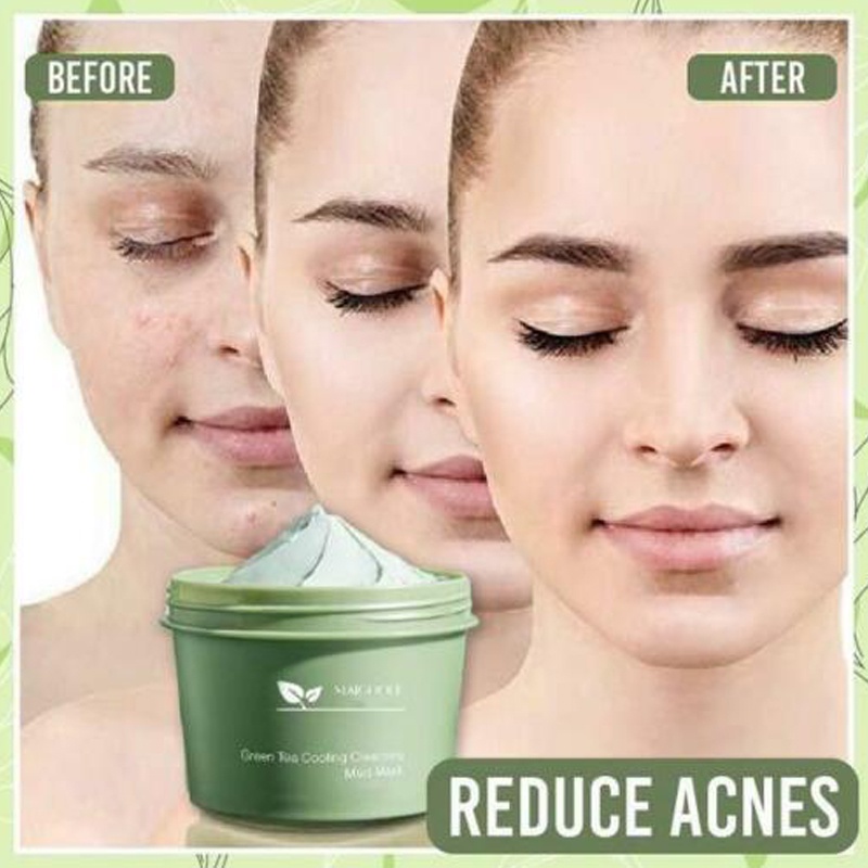 Mặt Nạ Bùn Trà Xanh 100G Làm Sạch Sâu Loại Bỏ Mụn Đầu Đen Và Se Khít Lỗ Chân Lông