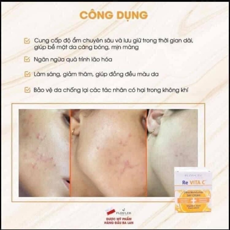 Kem dưỡng trắng da mặt Re Re Vita C  giúp dưỡng da trắng sáng, mờ thâm nám, chống lão hoá với Retinol và Vitamin C 50ml