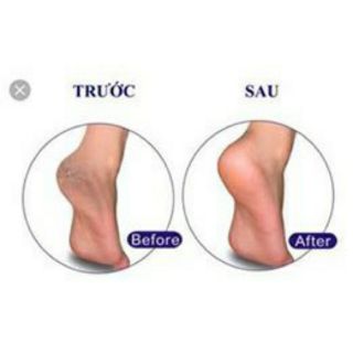 Kem trị nứt gót B.A Thailand
