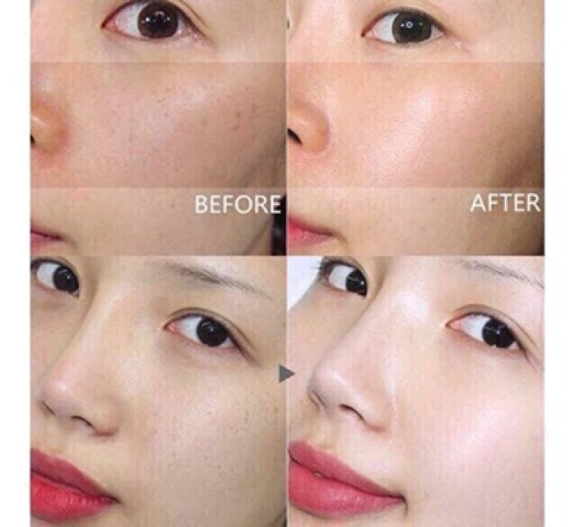 (SIÊU KHUYẾN MÃI -KEM NÁM TÀN NHANG DONGSUNG MẪU MỚI) | BigBuy360 - bigbuy360.vn