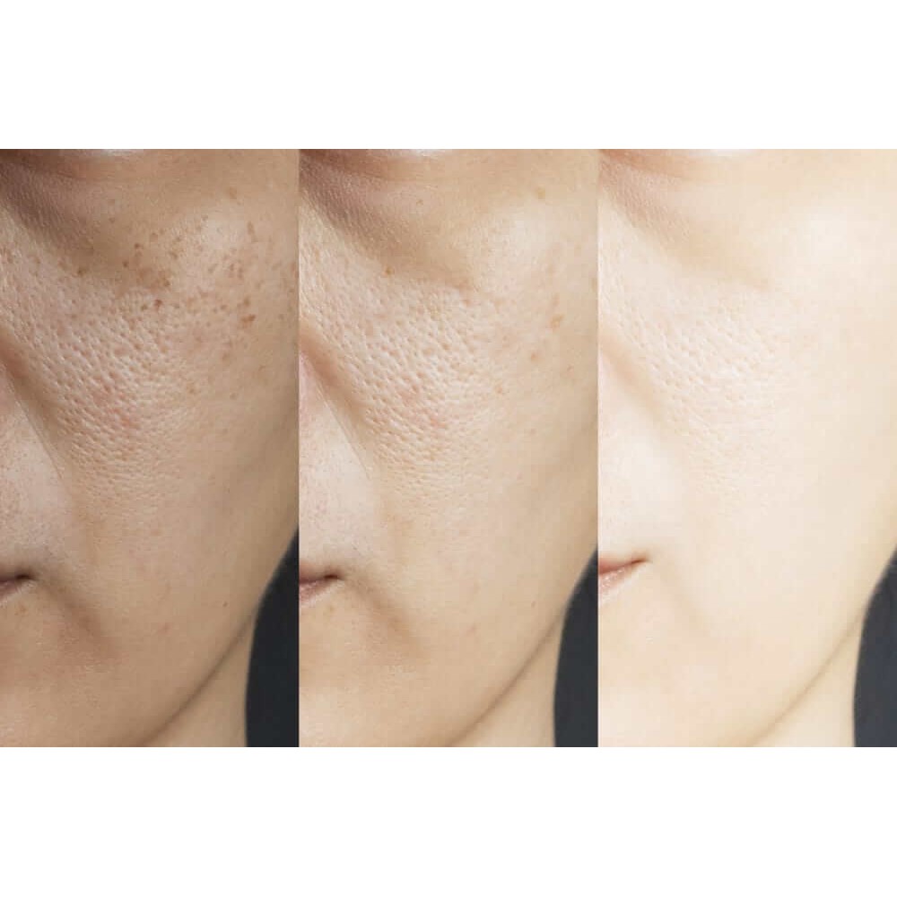 (chính hãng) - Serum HEYXI se khít lỗ chân lông dưỡng ẩm làm mềm da giúp cho da sáng khỏe tự tin | BigBuy360 - bigbuy360.vn