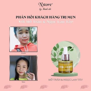 Mỡ trăn ngọc lan tây Nstore