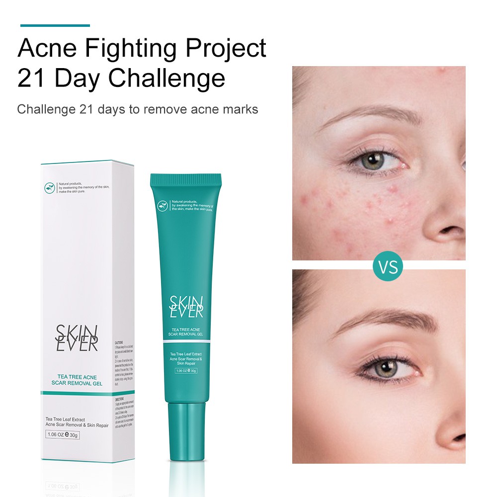 Gel làm mờ sẹo mụn SKIN EVER chiết xuất từ cây trà chăm sóc da hiệu quả 30g | BigBuy360 - bigbuy360.vn