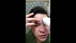 Máy hút mụn Black Head Detector