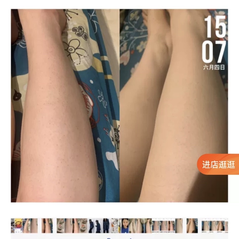 Kem URÊ BAOZHONGBAO Đánh Bay Viêm Lỗ Chân Lông Giúp Trắng Da Mịn Màng Dưỡng Ẩm Căng Bóng Da Kem Dưỡng Trắng