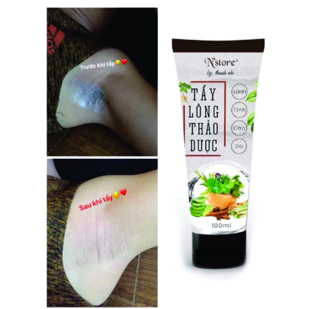 Kem tẩy lông thảo dược N'store | BigBuy360 - bigbuy360.vn