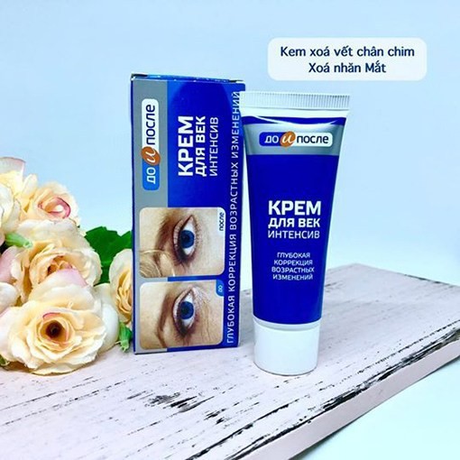 Kem trẻ hóa xóa nhăn vùng mắt Kpem Nga - giảm vết chân chim