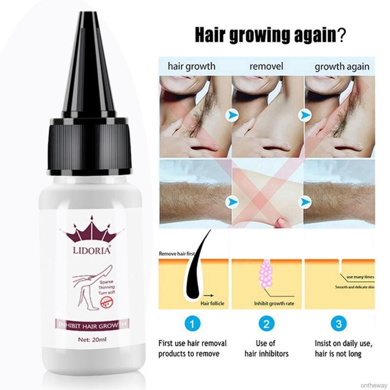 [Hàng mới về] Tinh chất ức chế mọc tóc sửa chữa 20ml | BigBuy360 - bigbuy360.vn