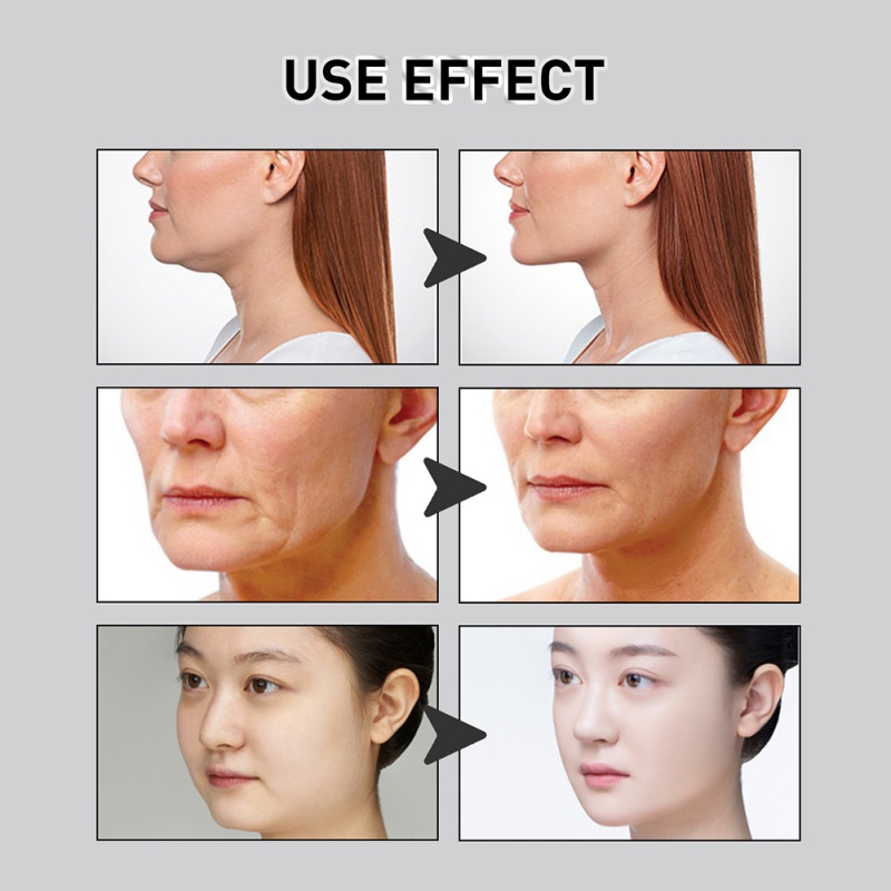 Set 40 Miếng Dán Nâng Cơ Mặt Tạo Cằm Chữ V Thon Gọn