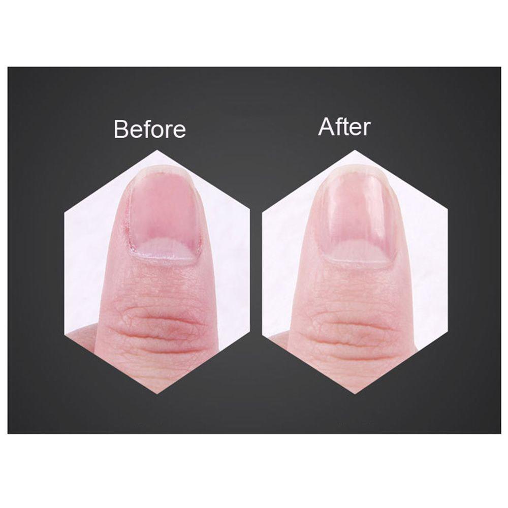 Dũa Móng Tay Chuyên Nghiệp 320 / 400 / 3000