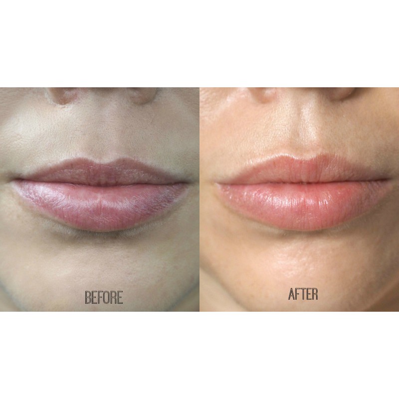 Kem Dưỡng Hỗ Trợ Phục Hồi Độ Ẩm &amp; Bảo Vệ Môi La Roche-Posay Cicaplast Lips 7.5ml