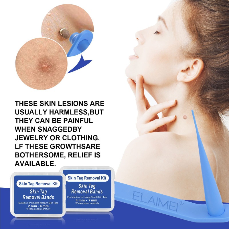 Thiết Bị Loại Bỏ Mụn Thịt Dư Trên Da Tiện Dụng