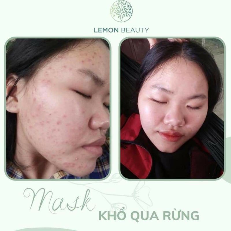 Mask khổ qua rừng Lemonbeauty