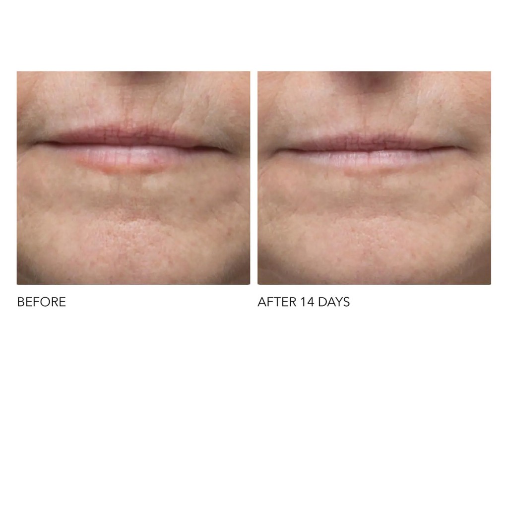 [Unbox/ Fullbox] Serum Giúp Sáng Da, Chống Lão Hoá Dr Dennis Gross Skincare Ferulic + Retinol Brightening Solution 30ml