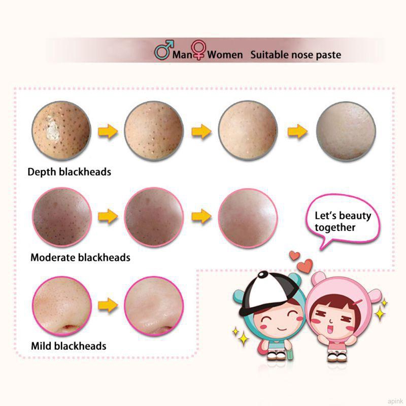 Mặt nạ lột mụn đầu đen vùng mũi 3 bước trong 1 BIOAQUA | BigBuy360 - bigbuy360.vn