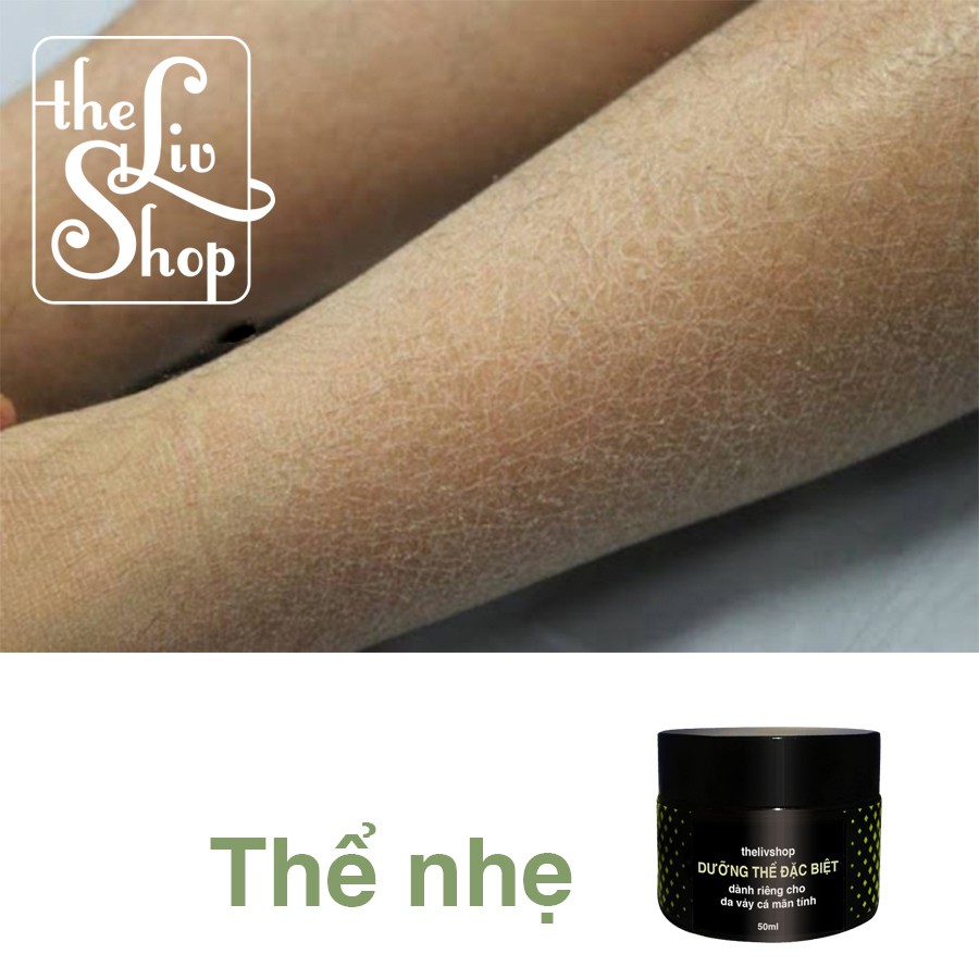 Da vảy cá, da rắn -  Kem dưỡng da đặc biệt homemade