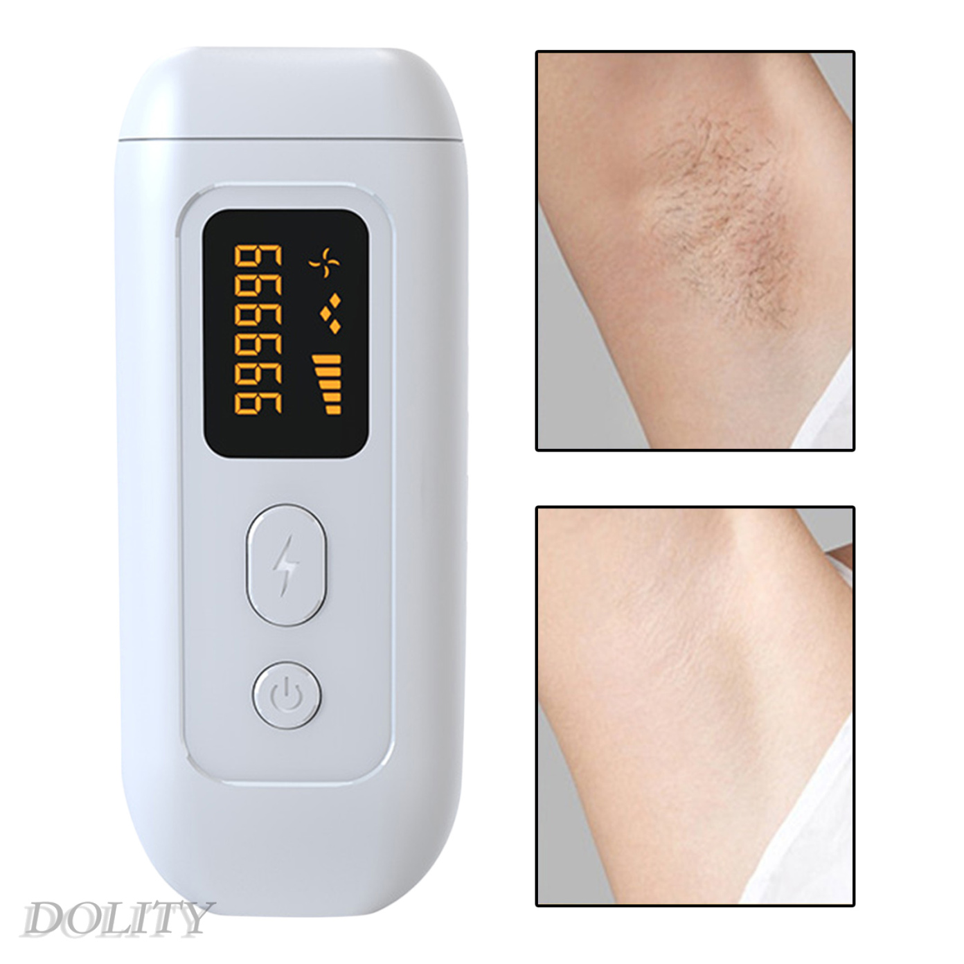 (Hàng Mới Về) Máy Triệt Lông Bằng Laser 990000 Flashes Có Phích Cắm Uk | BigBuy360 - bigbuy360.vn