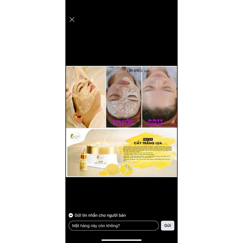 Cấy trắng lụa | BigBuy360 - bigbuy360.vn