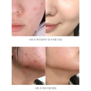 Toner Some By Mi AHA BHA PHA 30 Days 150ml