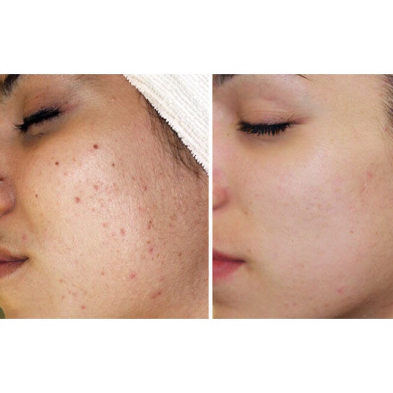 Noãn thực vật mới