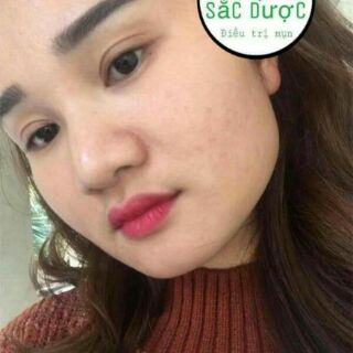 Sữa rửa mặt thảo mộc thiên nhiên