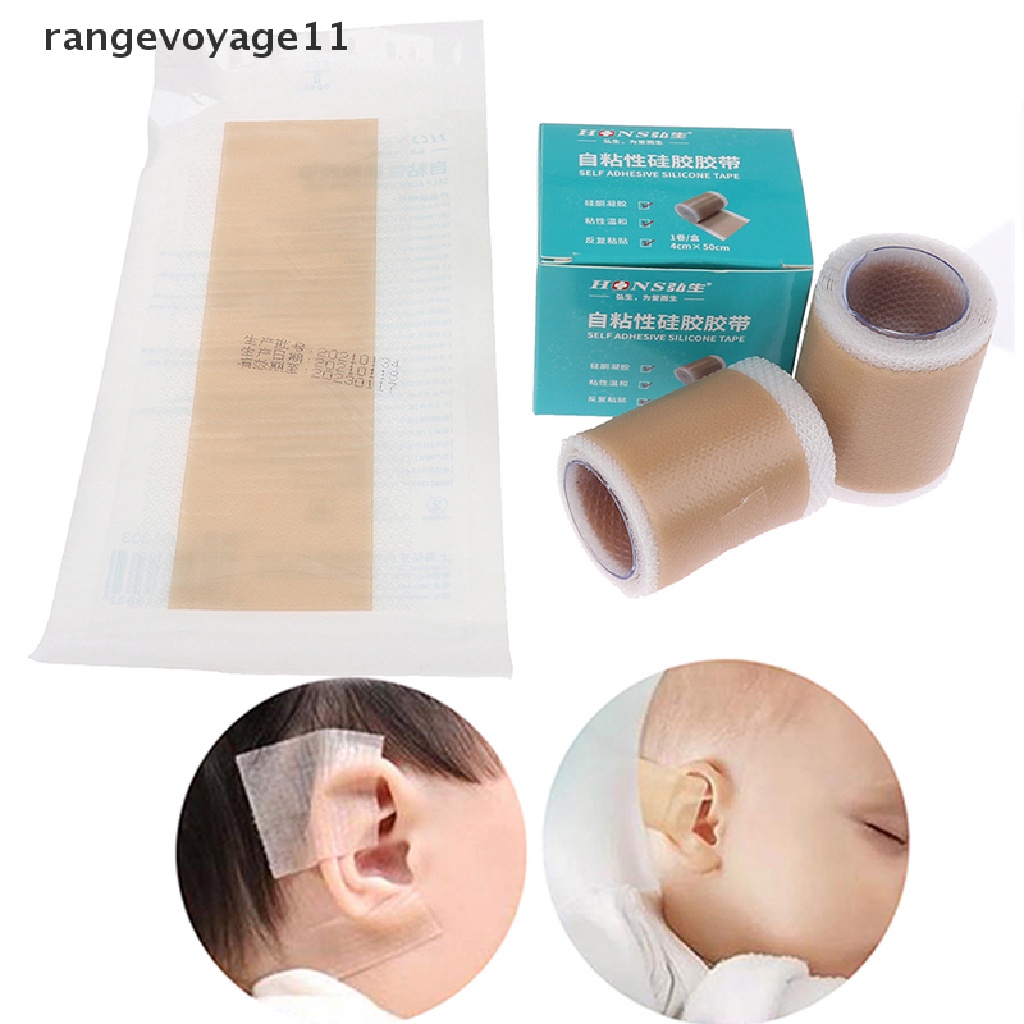 Miếng Dán Silicon Chỉnh Sửa Tai Cho Bé Sơ Sinh