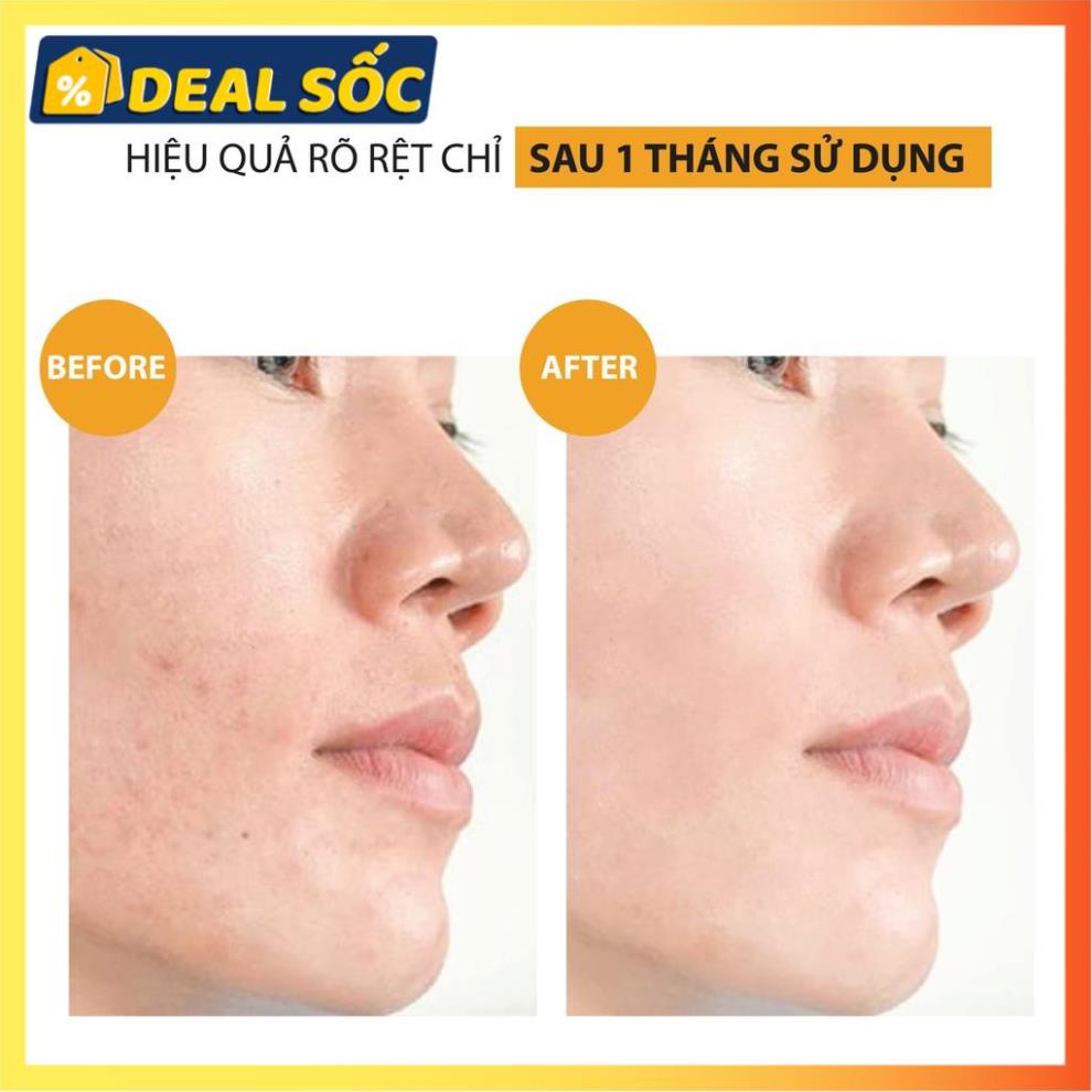 Serum Trắng Da 🎁CÓ MÃ GIẢM GIÁ🎁 Serum vitamin C - dưỡng da mờ thâm | BigBuy360 - bigbuy360.vn