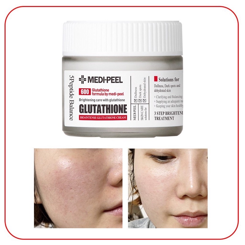 Kem dưỡng trắng da Medipeel Glutathione