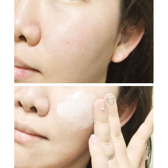 Kem Dưỡng Ẩm Chuyên Sâu Cho Da Rất Khô, Bioderma Atoderm Intensive Baume