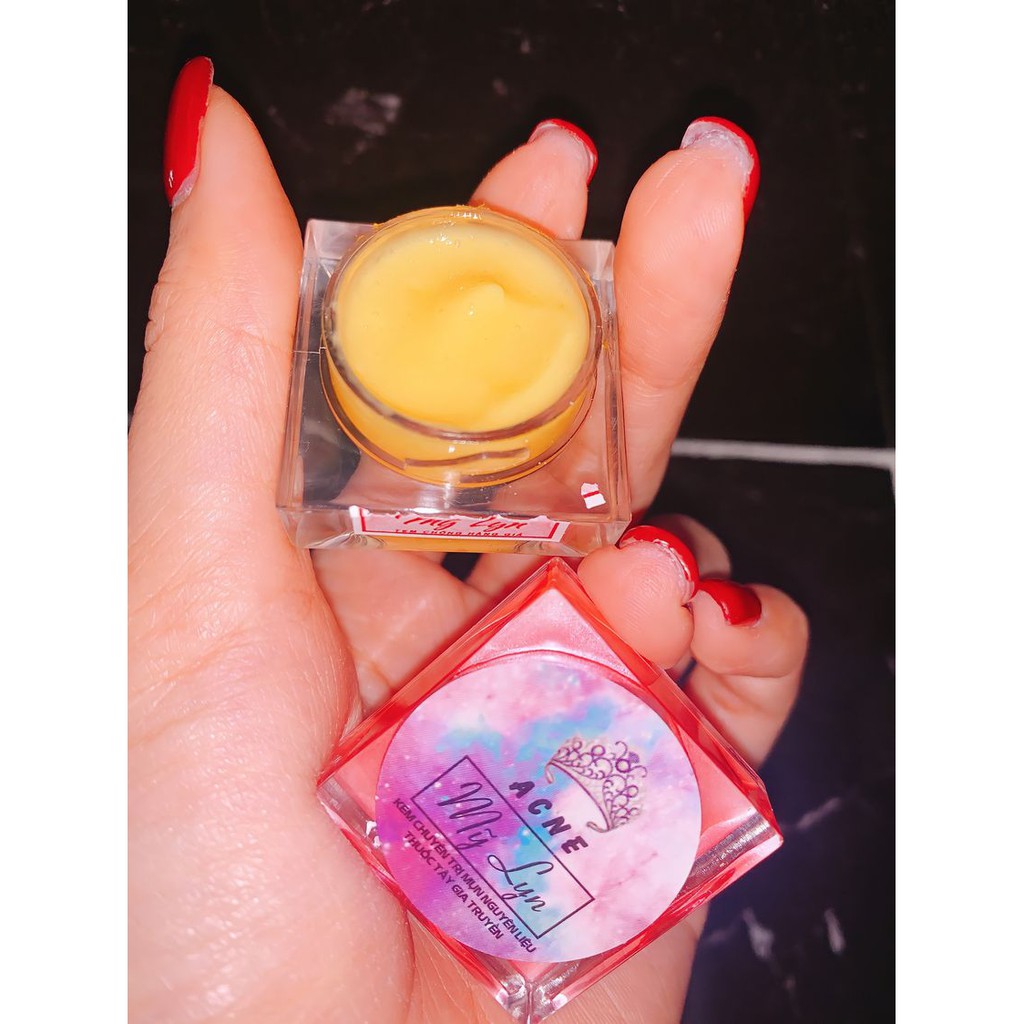 Kem Mụn Acne Mỹ Lyn Giúp Giảm Mụn, Ngừa Thâm Hiệu Qủa Sau 7-10 Ngày Sử Dụng | BigBuy360 - bigbuy360.vn