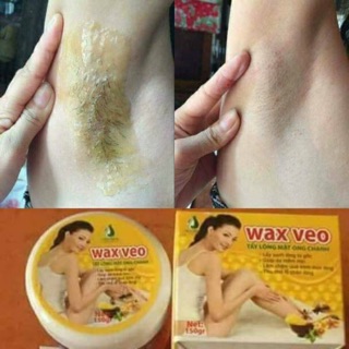 WAS  LÔNG REMOVE VEO VÀ MỠ TRĂN TRIỆT LÔNG VĨNH VIỄN