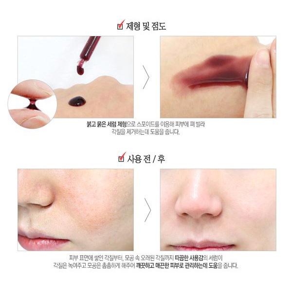 ( GÓI SAMPLE ) Tinh Chất Red Peel Tingle Serum Sample Dạng Gói So Natural (2,5ml)