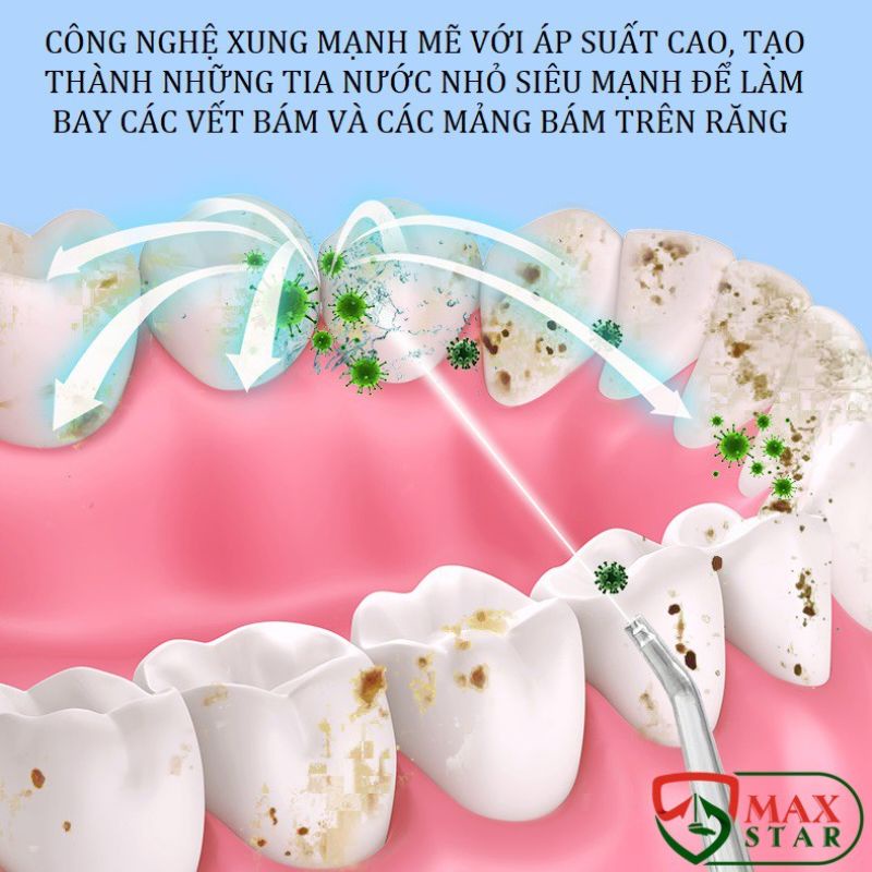 Máy Tăm Nước Cầm Tay - Tăm Nước Vệ Sinh Răng Miệng Oral Irrigator Bản Quốc Tế Chuẩn Châu Âu có sẵn