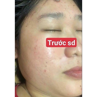 cốt sâm tái tạo da handmade