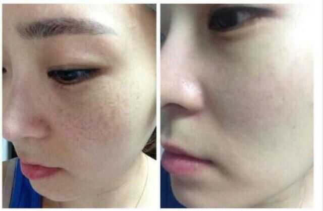 Tảo Diệp Lục Collagen Kyo Chính Hãng | BigBuy360 - bigbuy360.vn