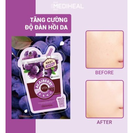 Combo 5 Mặt Nạ Giấy Việt Quất Ngăn Ngừa Lão Hóa Da - Mediheal Acaiberry Vita Mask 20ml-Dưỡng Ẩm, Sáng Da, Tăng Đàn Hồi