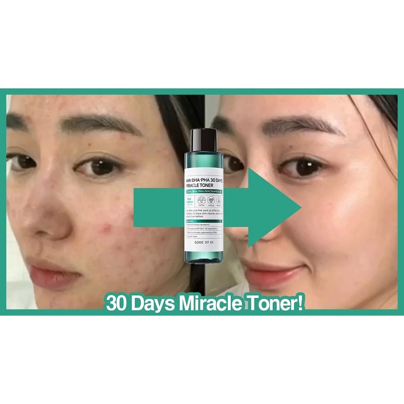 Nước hoa hồng some by mi AHA-BHA-PHA 30 Days Miracle Toner Hàn Quốc 150ml