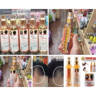 Xịt Mọc Tóc Genive 120Ml Thái Lan