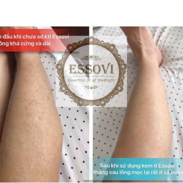 kem tẩy lông essovi 30g, kem tẩy lông toàn thân