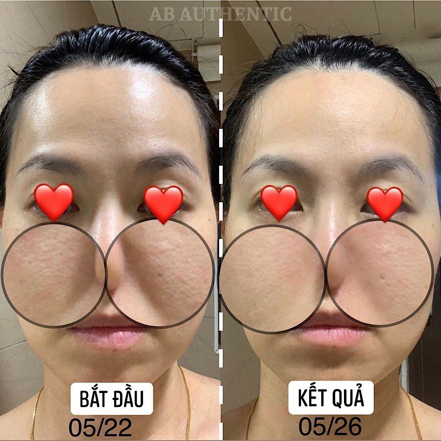 Vỉ Sample Peel da CNP rx Skin Rejuvenating Intensive Peel giúp làm căng bóng da, phục hồi lão hóa, mờ sạm nám.