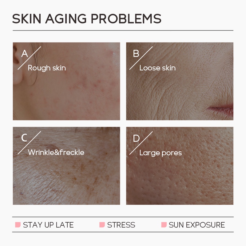 Serum Dưỡng Da Mặt Giảm Nếp Nhăn Fenyi 1% Retinol 17ml